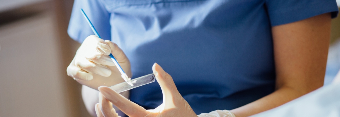 Claiming Medical Negligence Compensation For Smear Test Errors
