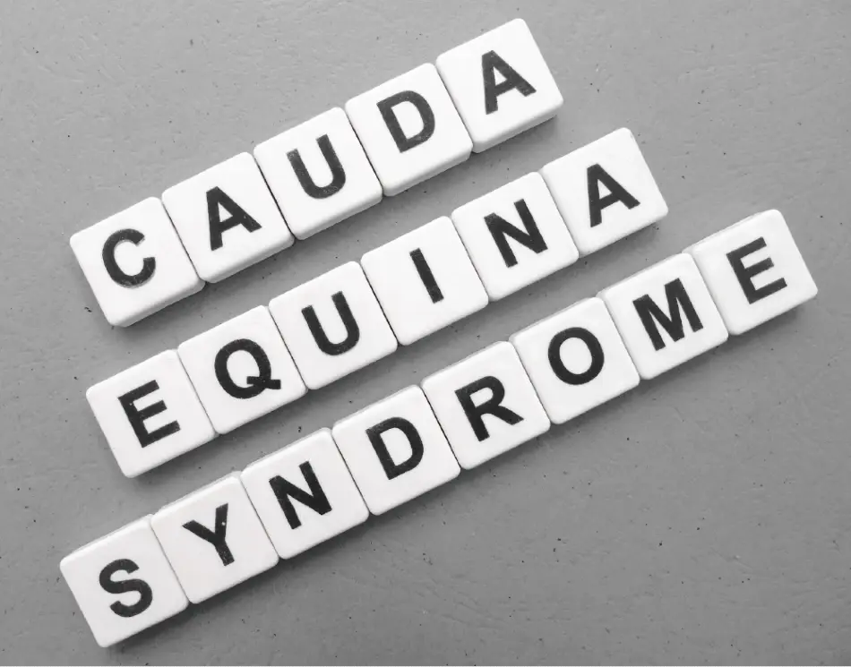 Caudia equina syndrome image